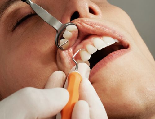 Cosmetic Dentistry vs. General Dentistry: Why We Do Both