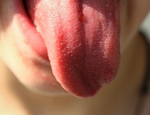 What Your Tongue May Be Trying to Tell You