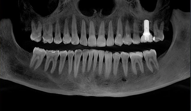 tech 3D CT Scanning